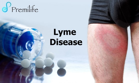 Lyme-Disease