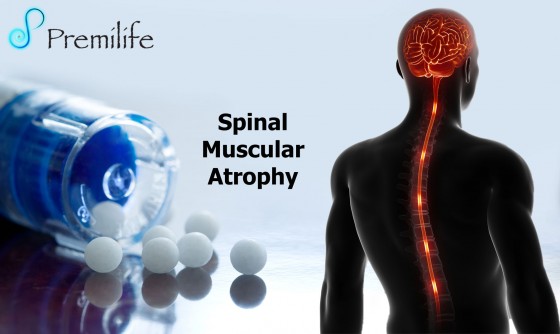 Spinal-Muscular-Atrophy