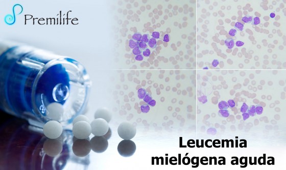acute-myeloid-leukemia-spanish