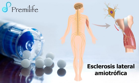 amyotrophic-lateral-sclerosis-spanish