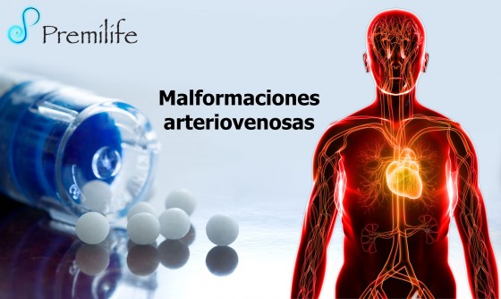 arteriovenous-malformations-spanish arteriovenous-malformations-spanish
