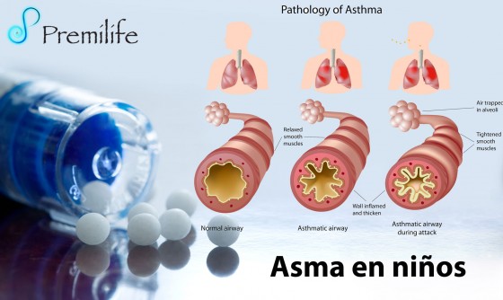 asthma-in-children-spanish