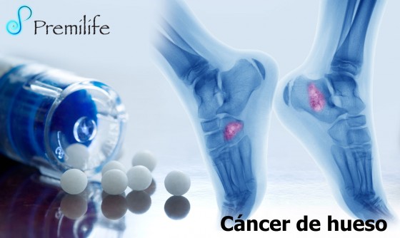 bone-cancer-spanish bone-cancer-spanish