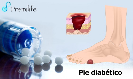 diabetic-foot-spanish