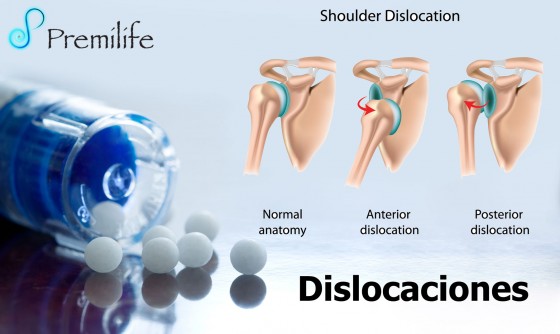 dislocations-spanish