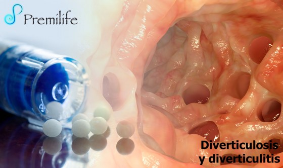 diverticulosis-and-diverticulitis-spanish