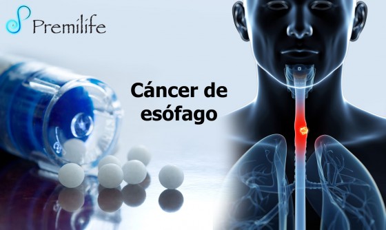 esophageal-cancer-spanish esophageal-cancer-spanish