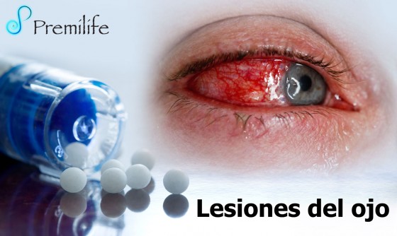 eye-injuries-spanish eye-injuries-spanish