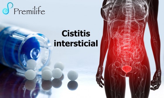 interstitial-cystitis-spanish