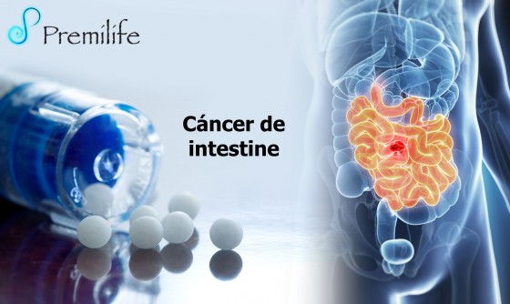 intestinal-cancer-spanish intestinal-cancer-spanish