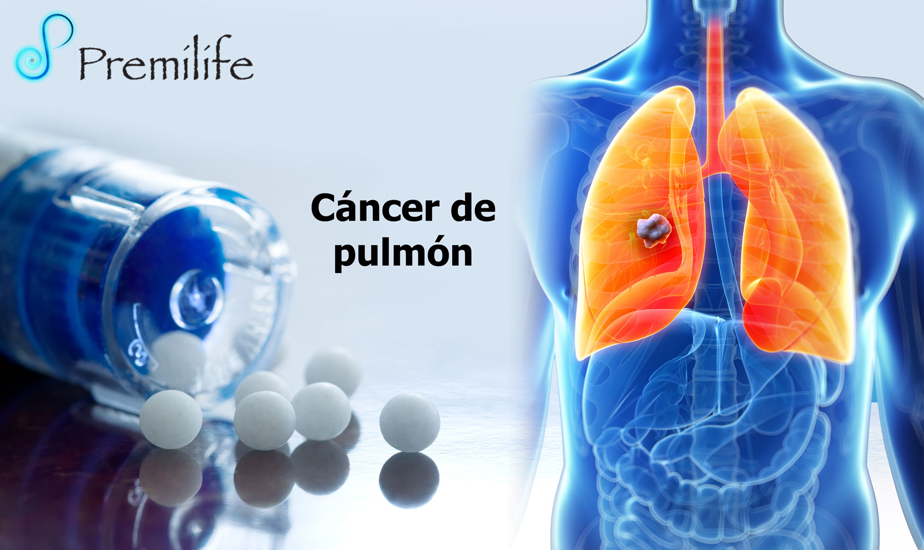 Se puede curar el cancer de pulmon en estadio 4
