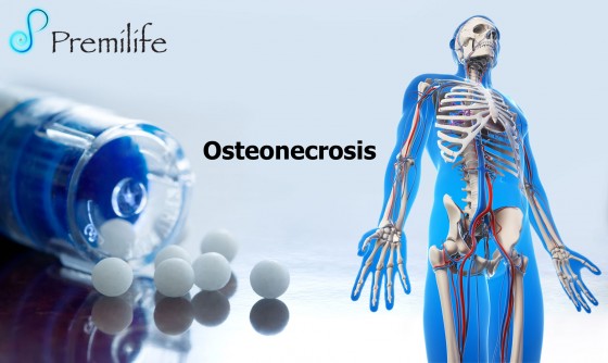 osteonecrosis-spanish osteonecrosis-spanish