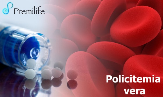 polycythemia-vera-spanish polycythemia-vera-spanish
