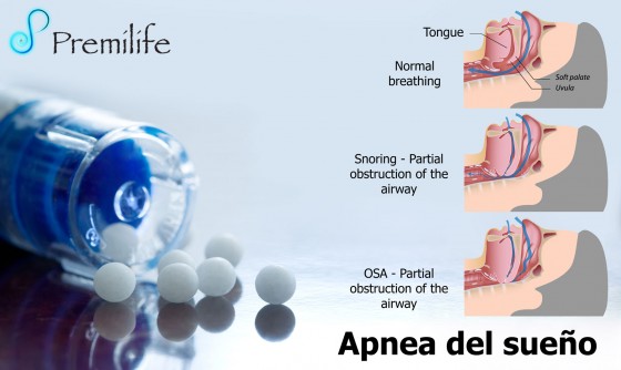 sleep-apnea-spanish sleep-apnea-spanish