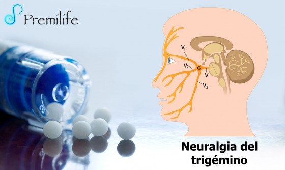 trigeminal-neuralgia-spanish
