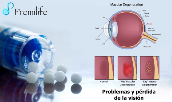 vision-impairment-and-blindness-spanish vision-impairment-and-blindness-spanish