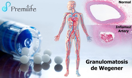 wegener's-granulomatosis-spanish wegener's-granulomatosis-spanish