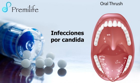 yeast-infections-spanish