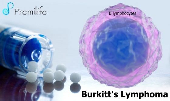 Burkitt's-Lymphoma