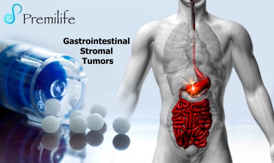 Gastrointestinal-Stromal-Tumors Gastrointestinal-Stromal-Tumors