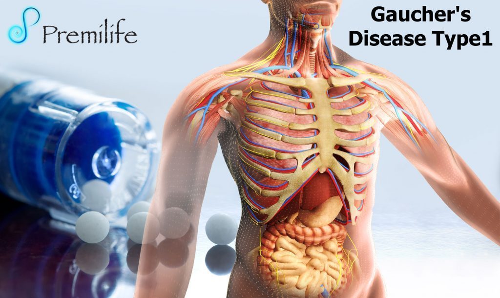 Gaucher's Disease Type 1 Premilife Homeopathic Remedies