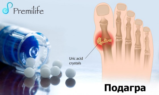 Gout-russian Gout-russian