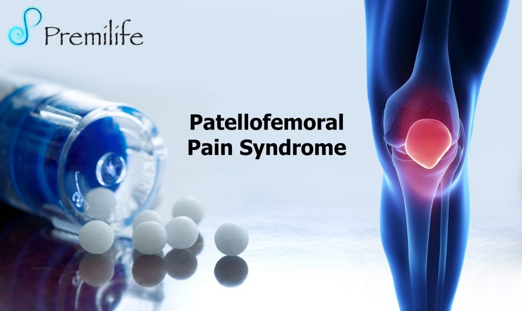 Patellofemoral Pain Syndrome Premilife Homeopathic Remedies
