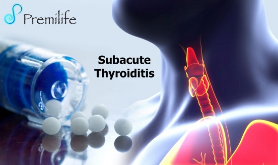 Subacute-Thyroiditis Subacute-Thyroiditis