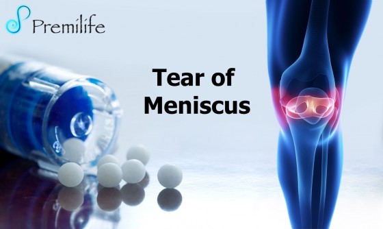 Tear-of-Meniscus