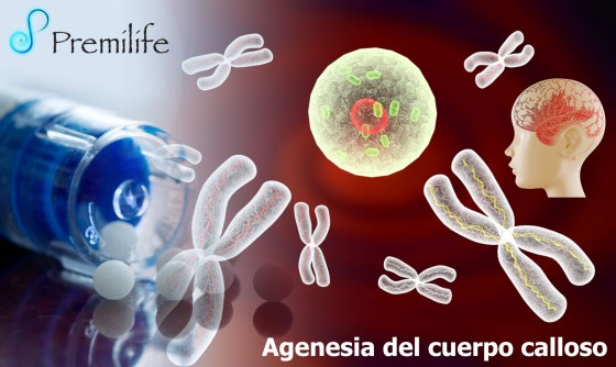 aicardi-syndrome-spanish aicardi-syndrome-spanish