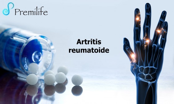 arthritis-rheumatoid-and-traumatic-spanish arthritis-rheumatoid-and-traumatic-spanish