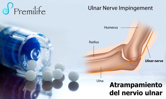 cubital-tunnel-syndrome-spanish cubital-tunnel-syndrome-spanish