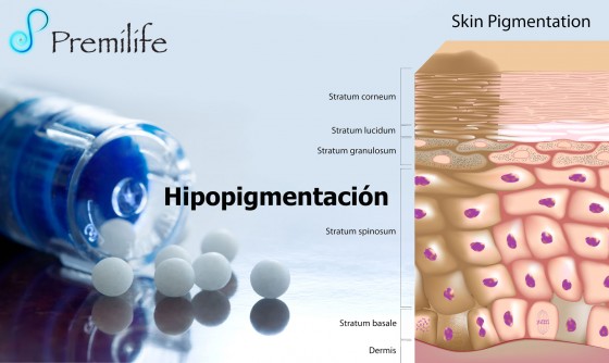 hypopigmentation-spanish hypopigmentation-spanish