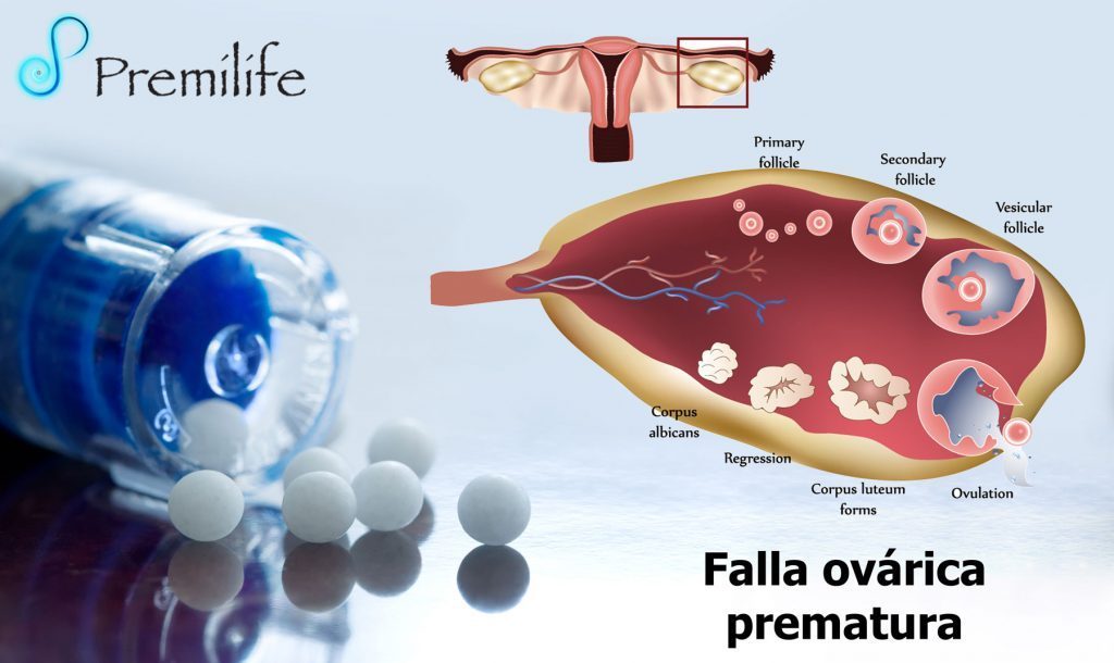 Tratamiento Insuficiencia Ovárica Prematura