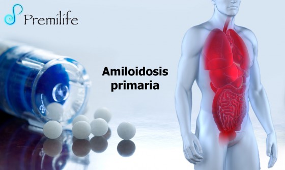 primary-amyloidosis-spanish