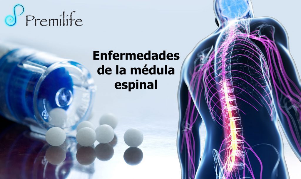 Enfermedades de la médula espinal | Premilife - Homeopathic Remedies