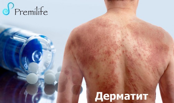 Dermatitis-russian