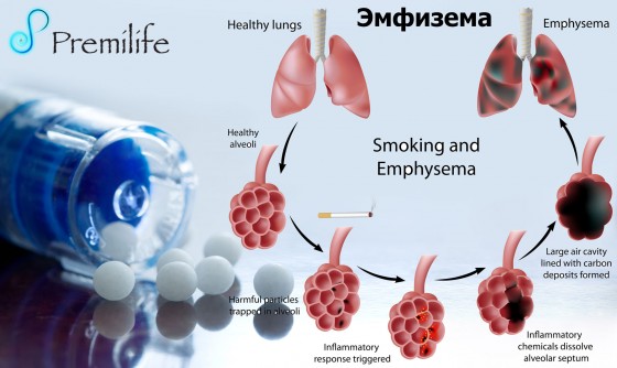 Emphysema-russian