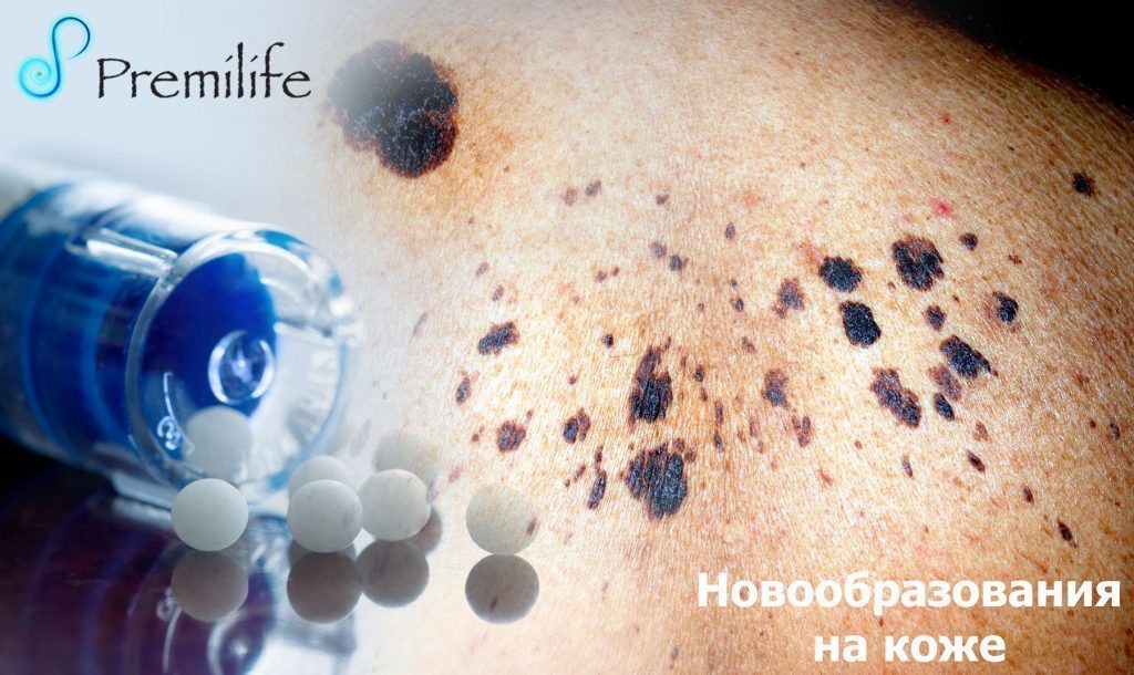 Новообразования на коже | Premilife - Homeopathic Remedies