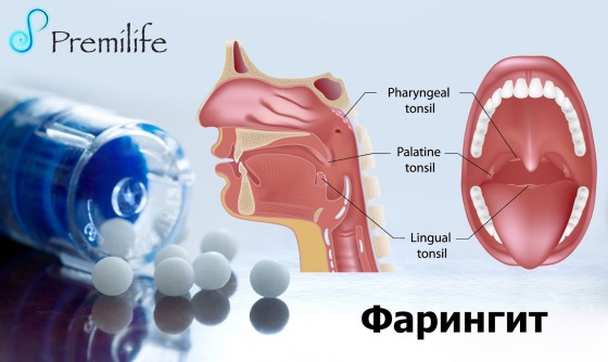 Pharyngitis-russian Pharyngitis-russian
