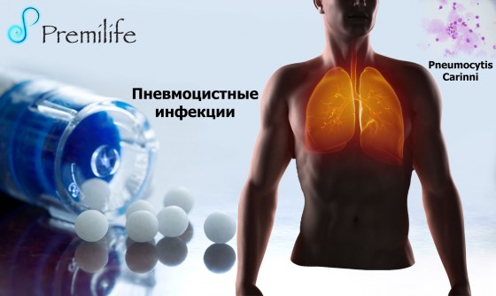 Pneumocystis-Infections-russian Pneumocystis-Infections-russian