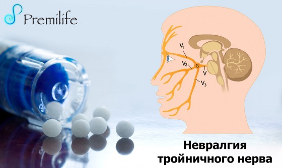 Trigeminal-Neuralgia-russian Trigeminal-Neuralgia-russian