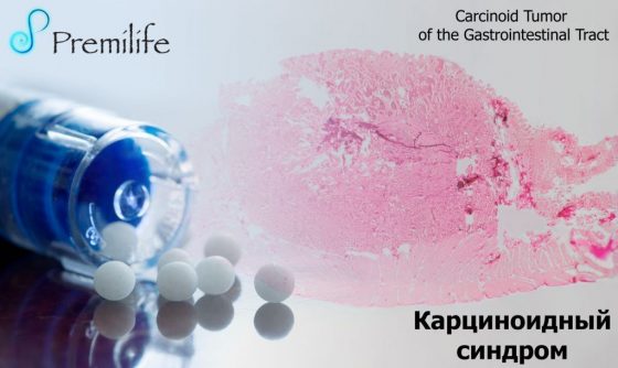 carcinoid-syndrome-russian carcinoid-syndrome-russian