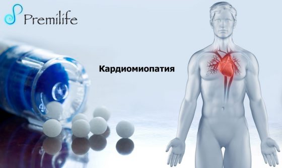 cardiomyopathy-russian cardiomyopathy-russian