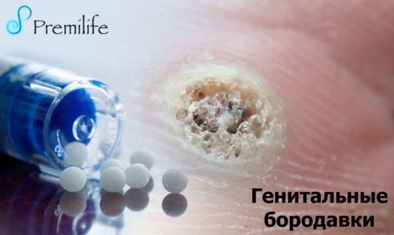 genital-warts-russian genital-warts-russian