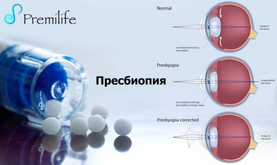 presbyopia-russian