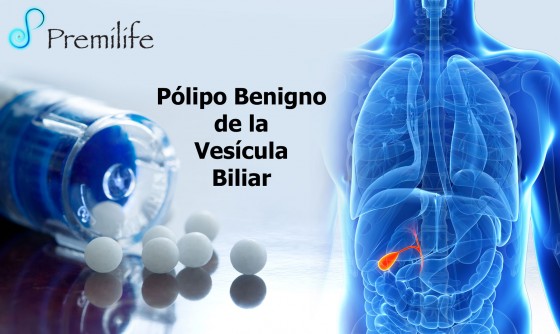Benign-Gallbladder-Polyp-spanish Benign-Gallbladder-Polyp-spanish